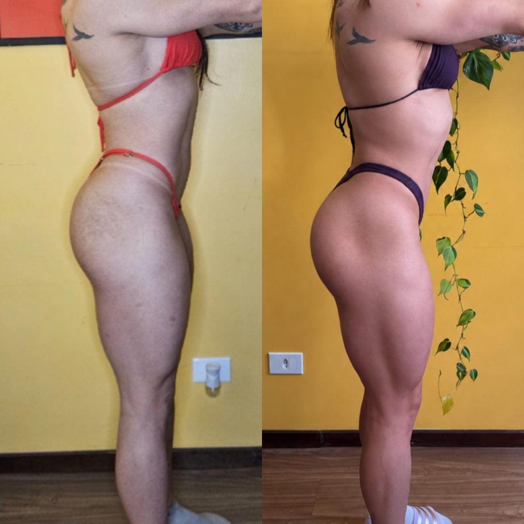 Resultado real de aluna, comparação de cintura, glúteos e pernas antes e depois